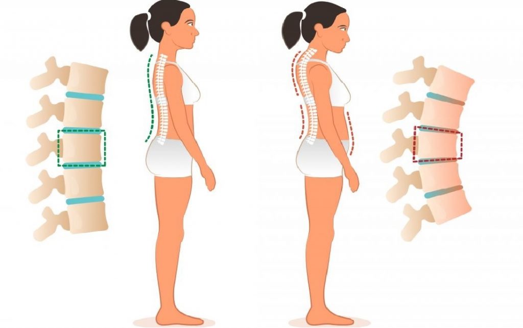gerinctornás kezelések